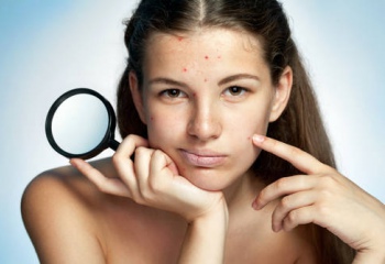 Что поможет добиться чистой кожи без угревой сыпи?  