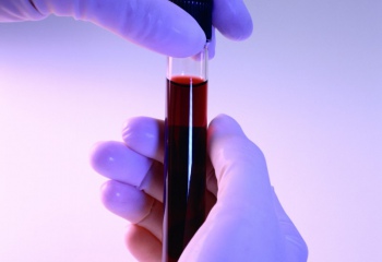 Как делать тест на беременность на основе анализа крови